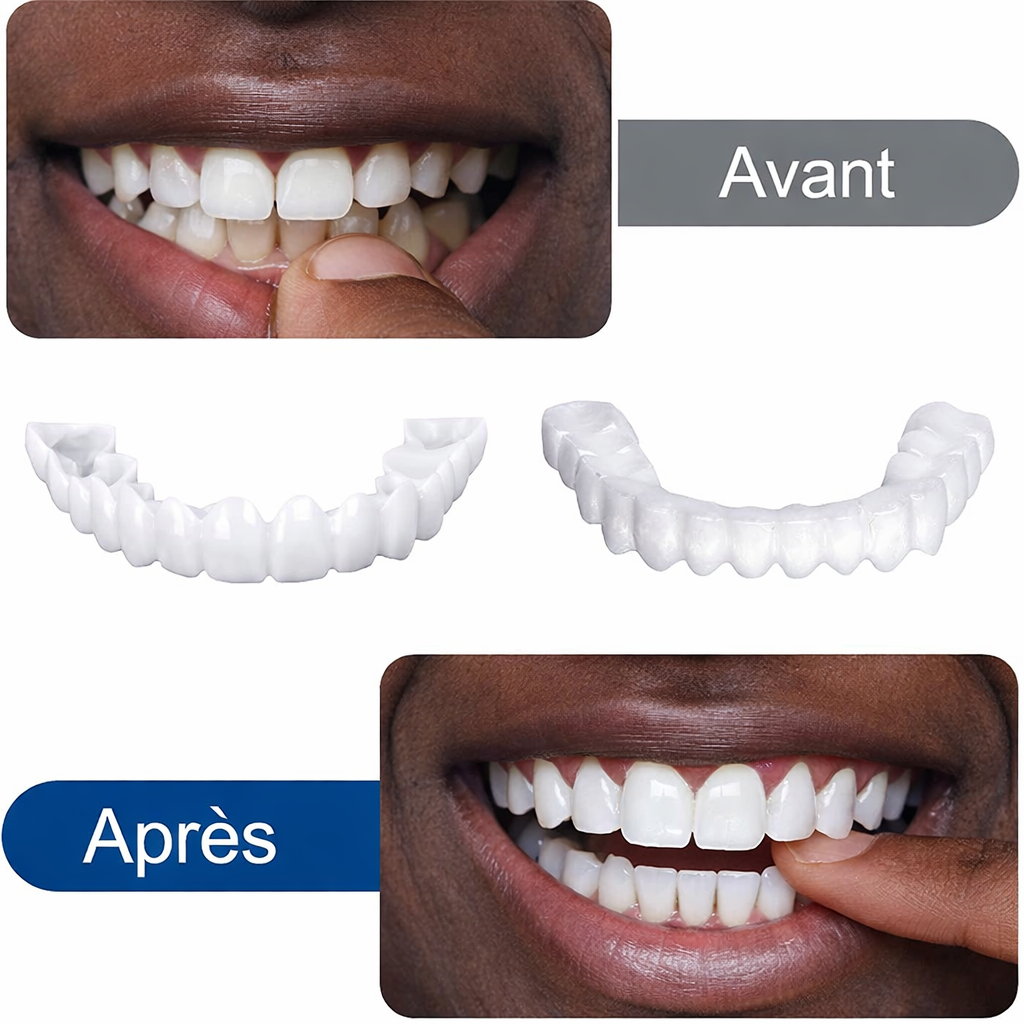 Prothèses dentaires un nouveau sourire