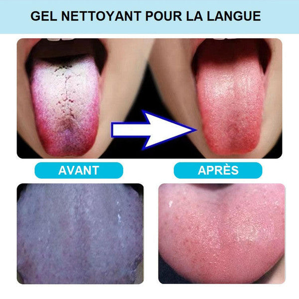 Gel + gratte langue